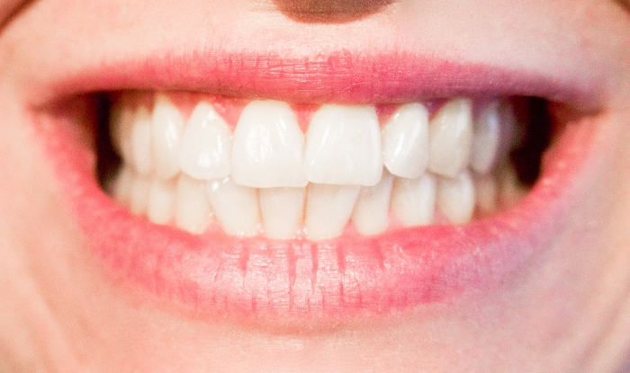 ¿Qué mancha mis dientes? Buenos hábitos para mantener la sonrisa blanca